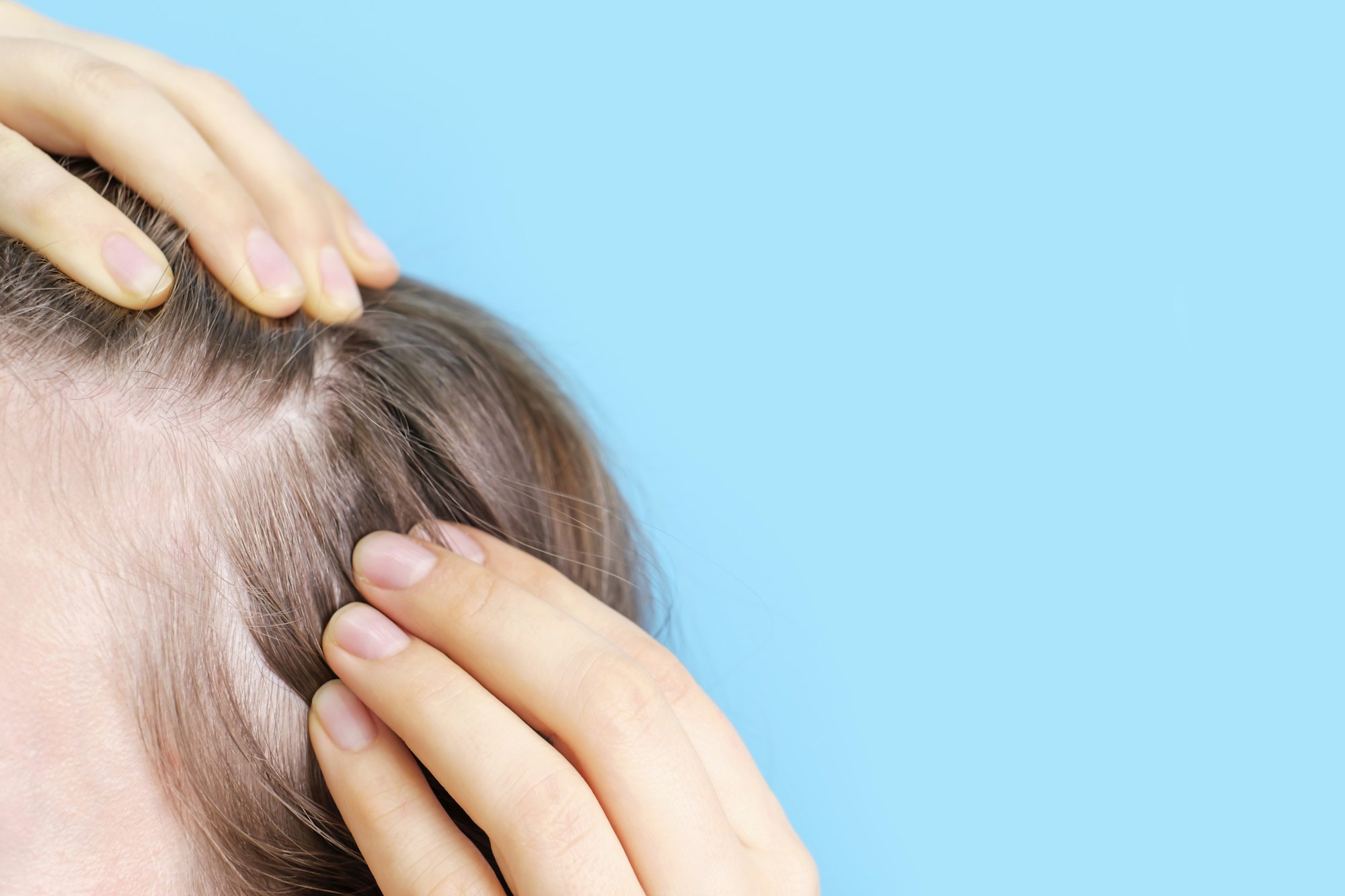 Girl touching her hair close-up on blue background, hair loss concept.